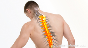 New Roads thoracic spine pain image 