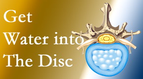New Roads Chiropractic Center uses spinal manipulation and exercise to enhance the diffusion of water into the disc which supports the health of the disc.