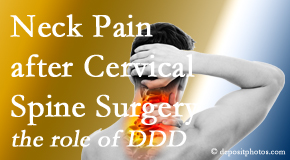 New Roads Chiropractic Center offers gentle care for neck pain after neck surgery.