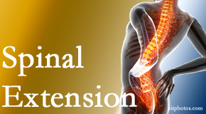 New Roads Chiropractic Center understands the role of extension in spinal motion, its necessity, its benefits and potential harmful effects. 