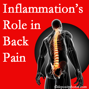 The role of inflammation in New Roads back pain is real. Chiropractic care can manage it.