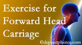 New Roads chiropractic treatment of forward head carriage is two-fold: manipulation and exercise.
