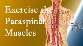 New Roads Chiropractic Center describes the importance of paraspinal muscles and their strength for New Roads back pain relief.