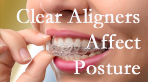 Clear aligners influence posture which New Roads chiropractic helps.