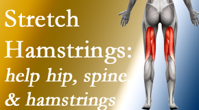 New Roads Chiropractic Center encourages back pain patients to stretch hamstrings for length, range of motion and flexibility to support the spine.
