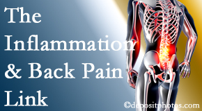 New Roads Chiropractic Center addresses the inflammatory process that accompanies back pain as well as the pain itself.