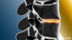 New Roads degenerative spinal changes 