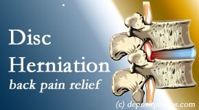 New Roads Chiropractic Center offers non-surgical treatment for relief of disc herniation related back pain. 