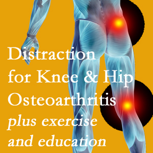A chiropractic treatment plan for New Roads knee pain and hip pain due to osteoarthritis: education, exercise, distraction.