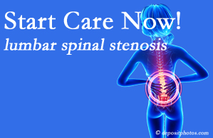 New Roads Chiropractic Center presents research that emphasizes that non-operative treatment for spinal stenosis within a month of diagnosis is beneficial. 