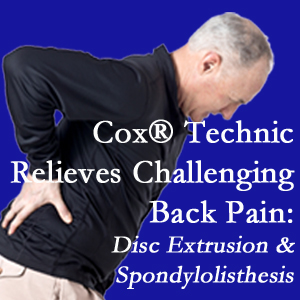 New Roads chiropractic care with Cox Technic relieves back pain due to a painful combination of a disc extrusion and a spondylolytic spondylolisthesis.